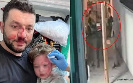 Bebek ve Baba Darbedildi Görüntüler Ortaya Çıktı