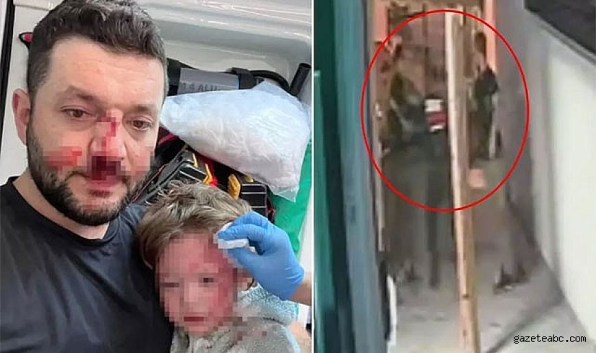 Bebek ve Baba Darbedildi Görüntüler Ortaya Çıktı