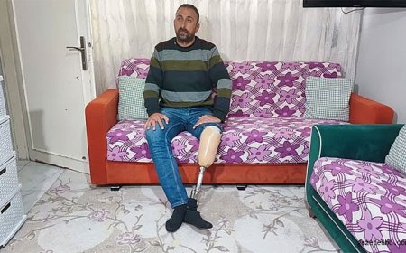 Bacağını Kaybeden Adamın Hapis Riski