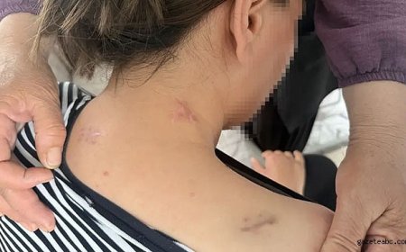 Uzaklaştırma Kararına Rağmen Kanlı Saldırı