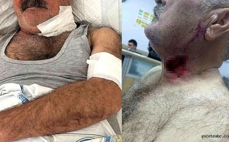 Sur İlçesinde Atın Saldırdığı Kişi Ağır Yaralandı