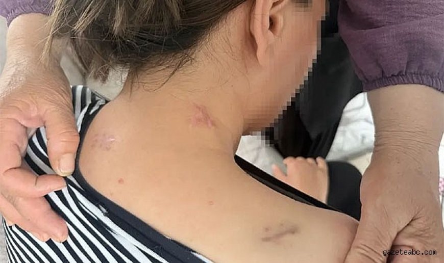 Uzaklaştırma Kararına Rağmen Kanlı Saldırı