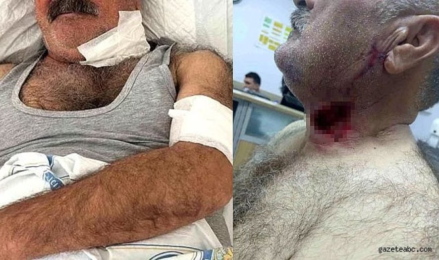 Sur İlçesinde Atın Saldırdığı Kişi Ağır Yaralandı